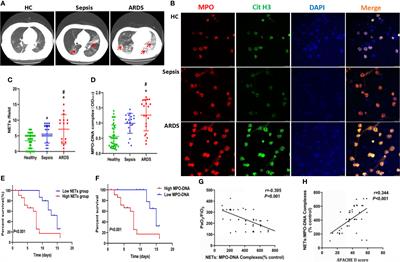 Tissue Factor-Enriched Neutrophil Extracellular Traps Promote Immunothrombosis and Disease Progression in Sepsis-Induced Lung Injury